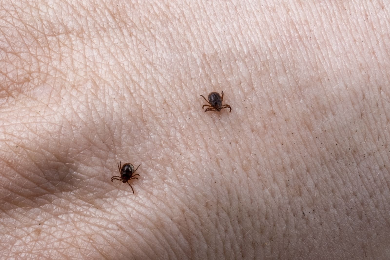 mite-male-hand-with-ticks_1600x1067.jpg