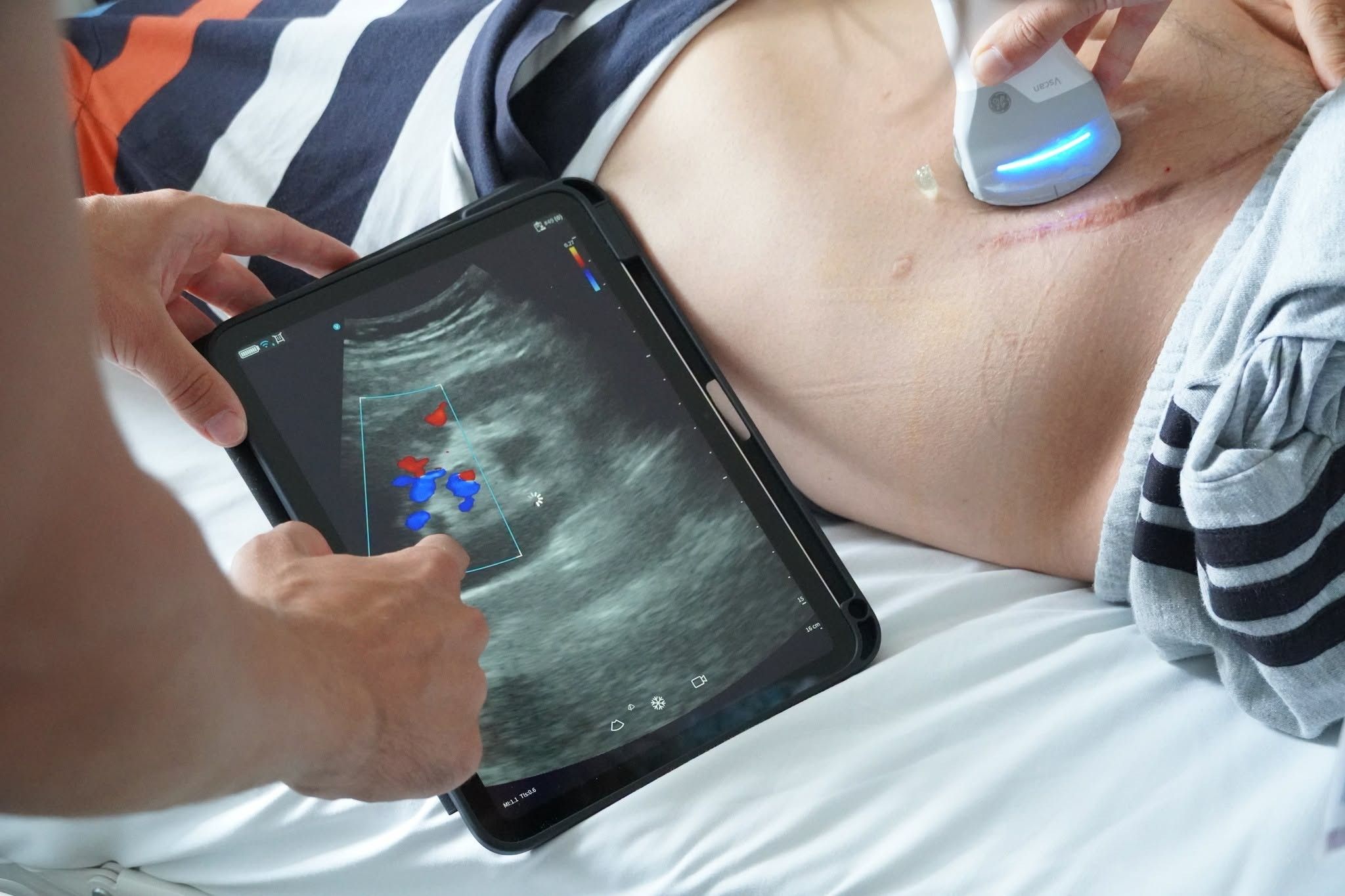 transplantspicka5.jpg